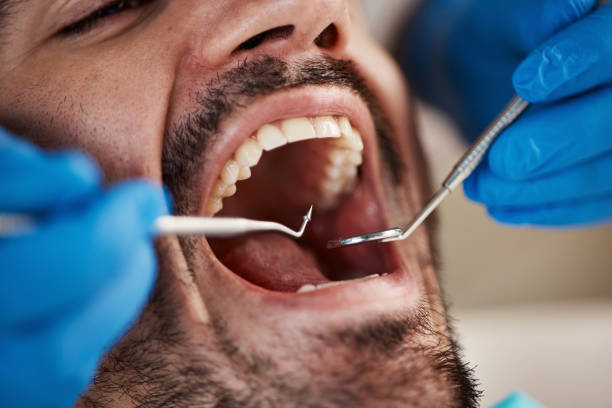 Best Urgent Dental Care for Toothaches in Raoul, GA