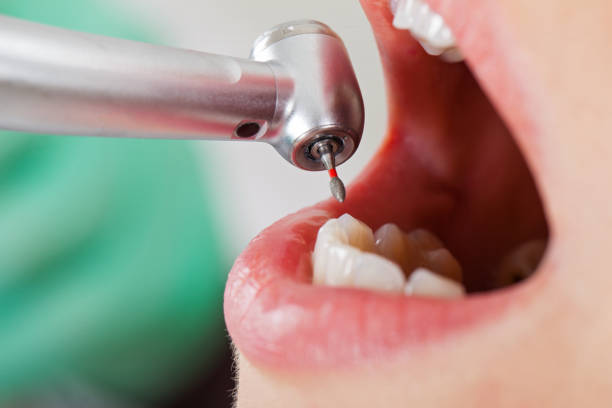 Best Walk-In Emergency Dental Services in Raoul, GA